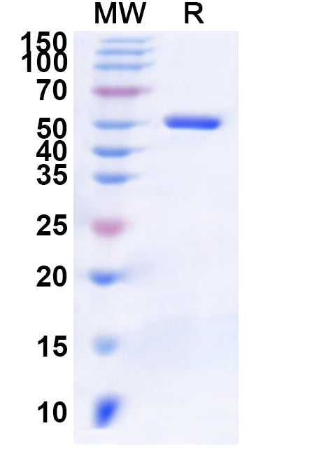 Recombinant Human ALDH6A1 Protein, N-His