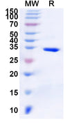 Recombinant Human FOXF1 Protein, N-GST & C-His