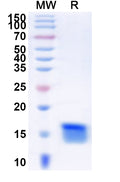 Recombinant Human FOXL1 Protein, N-His