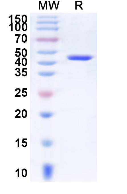 Recombinant Human ERCC8 Protein, N-His