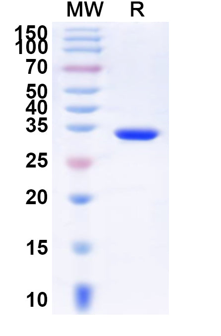 Recombinant Human ZNF750 Protein, N-His-KSI