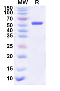 Recombinant Human MTA1 Protein, N-His