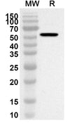 Western blot analysis was performed using anti-MTA1 polyclonal antibody at 1ug/mL on recombinant MTA1 (Catalog No. HA784012).