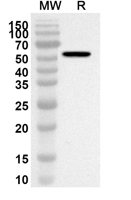 Western blot analysis was performed using anti-MTA1 polyclonal antibody at 1ug/mL on recombinant MTA1 (Catalog No. HA784012).