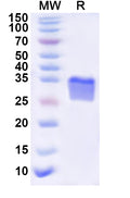 Recombinant Human ART3 Protein, N-His