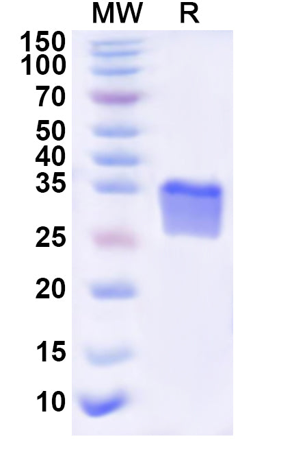 Recombinant Human ART3 Protein, N-His