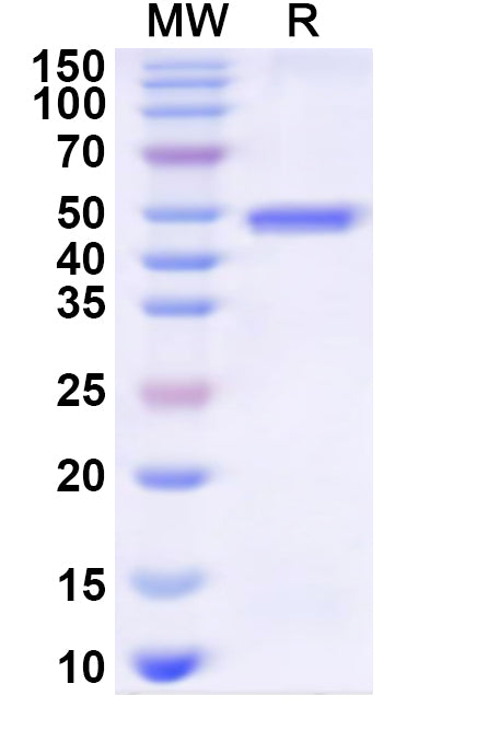 Recombinant Human GRB14 Protein, N-His
