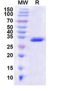 Recombinant Human P2RX1 Protein, N-His