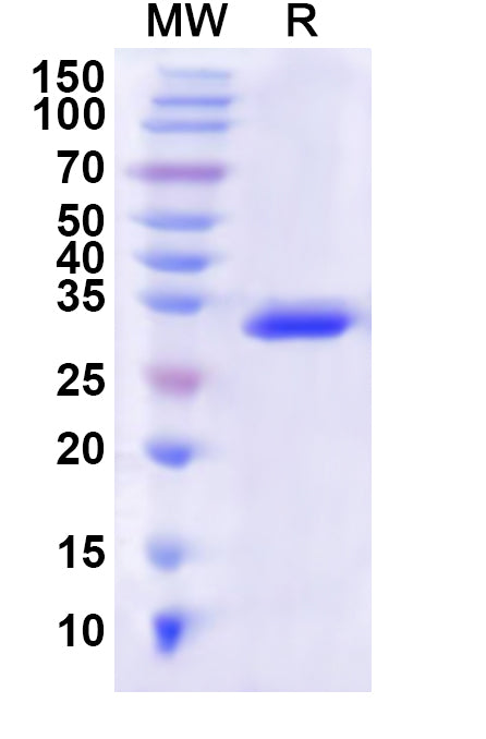 Recombinant Human P2RX1 Protein, N-His