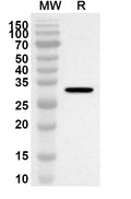 Western blot analysis was performed using anti-P2RX1 polyclonal antibody at 1ug/mL on recombinant P2RX1 (Catalog No. HA787012).