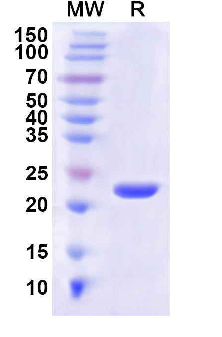 Recombinant Human MLEC Protein, N-His