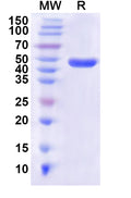 Recombinant Human DPYS Protein, N-His