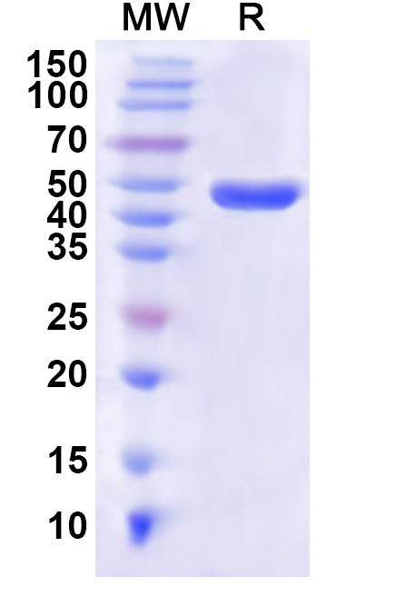 Recombinant Human DPYS Protein, N-His