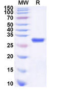 Recombinant Human TAP2 Protein, N-His