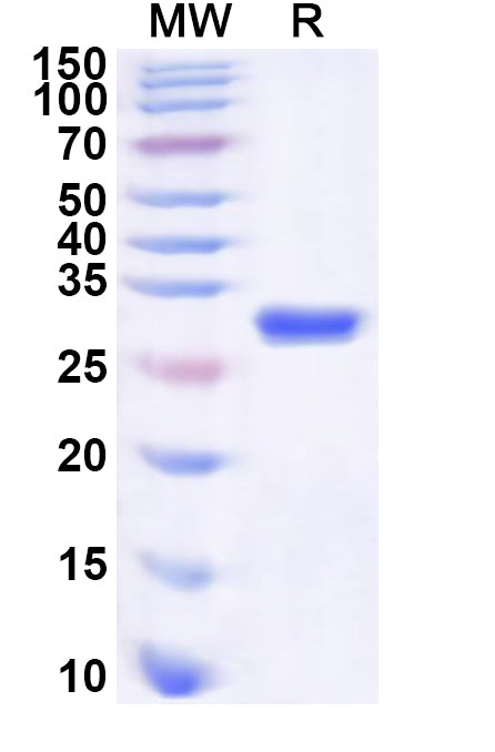 Recombinant Human TAP2 Protein, N-His