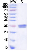 Recombinant Human SRSF11 Protein, N-His