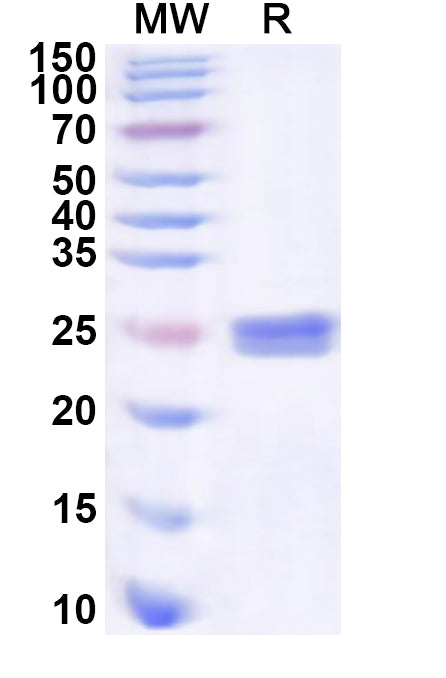 Recombinant Human SRSF11 Protein, N-His