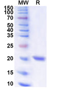Recombinant Human VEZF1 Protein, N-His