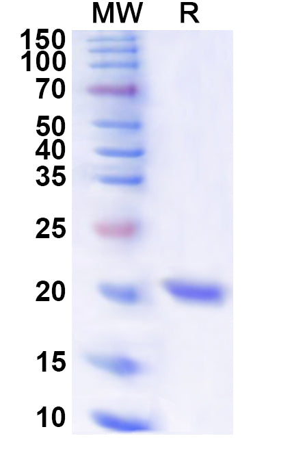Recombinant Human VEZF1 Protein, N-His