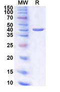 Recombinant Human POLA2 Protein, N-His