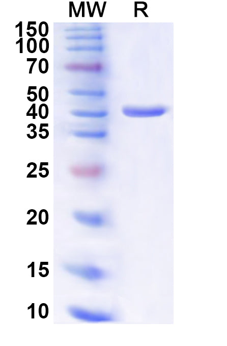 Recombinant Human POLA2 Protein, N-His