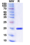 Recombinant Human SLBP Protein, N-His