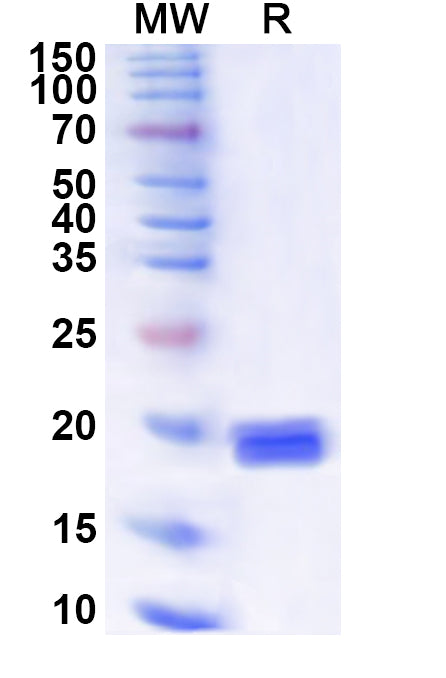 Recombinant Human HIC1 Protein, N-His