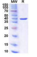 Recombinant Human KRT32 Protein, N-His