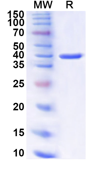 Recombinant Human KRT32 Protein, N-His