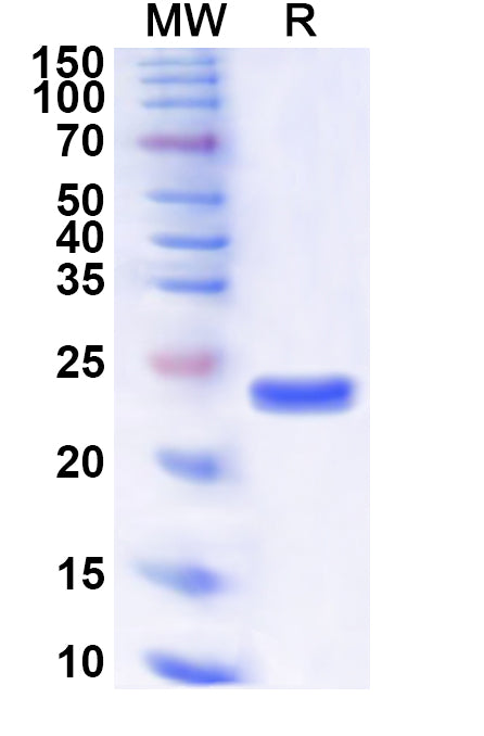 Recombinant Human GINS1 Protein, N-His