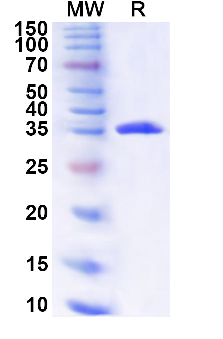 Recombinant Human NFATC4 Protein, N-His