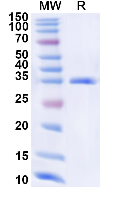 Recombinant Human CLCA4 Protein, N-His