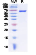 Recombinant Human GRM7 Protein, N-His