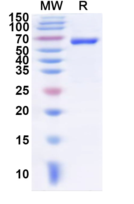 Recombinant Human GRM7 Protein, N-His