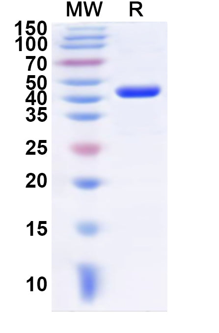 Recombinant Human KRT72 Protein, N-His