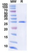 Recombinant Human EXOSC7 Protein, N-His