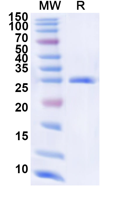 Recombinant Human EXOSC7 Protein, N-His