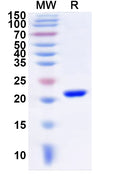 Recombinant Human JOSD1 Protein, N-His