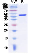 Recombinant Human NCF4 Protein, N-His