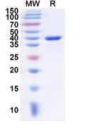Recombinant Human PLCB4 Protein, N-His