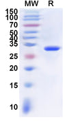 Recombinant Human QPRT Protein, N-His