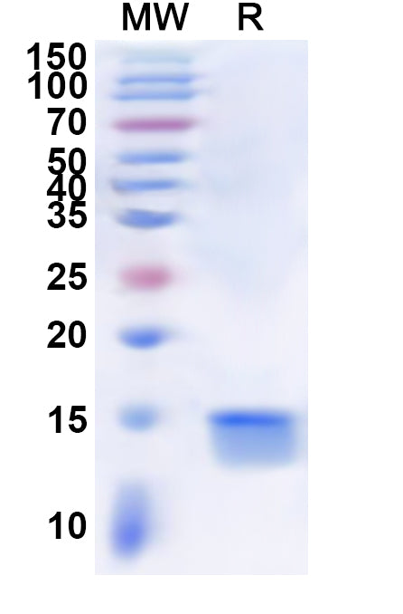 Recombinant Human DLGAP5 Protein, N-His