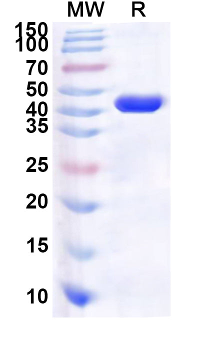 Recombinant Human SYCP1 Protein, N-His