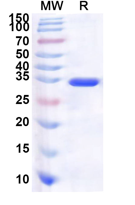 Recombinant Human PPP1R7 Protein, N-His
