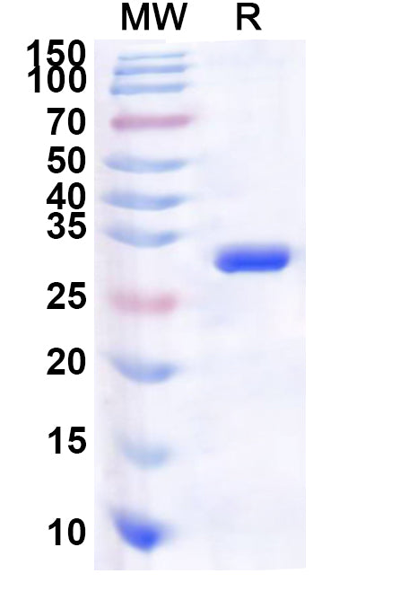 Recombinant Human TESK1 Protein, N-His