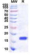 Recombinant Human NAB2 Protein, N-His