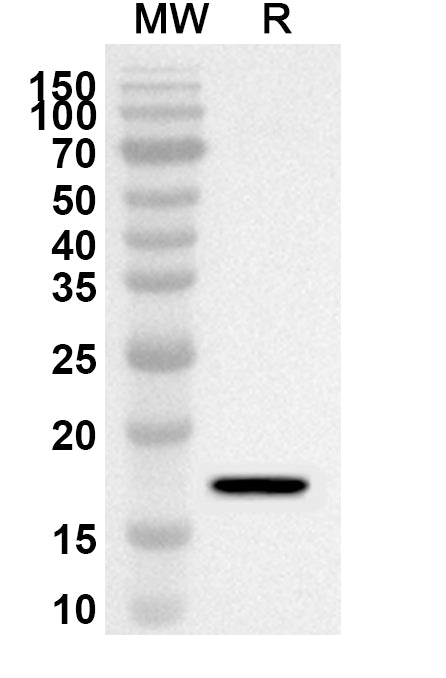 Western blot analysis was performed using anti-NAB2 polyclonal antibody at 1ug/mL on recombinant NAB2 (Catalog No. HA814012).