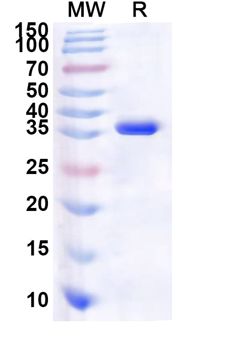 Recombinant Human TOMM34 Protein, N-His