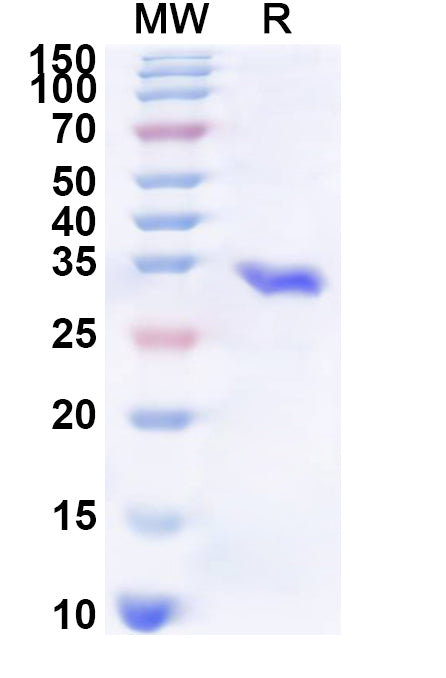 Recombinant Human NCOA2 Protein, N-His