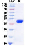 Recombinant Human NCOA1 Protein, N-His